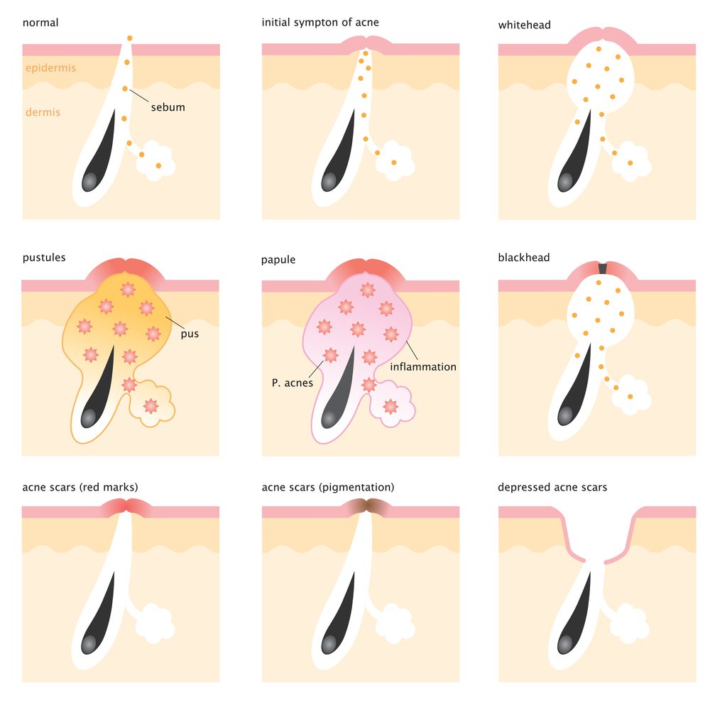 facial cleaning
