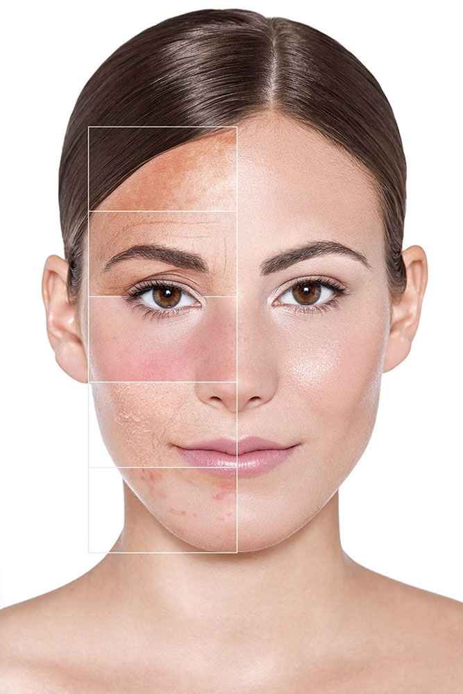 skinhasmanyfaces