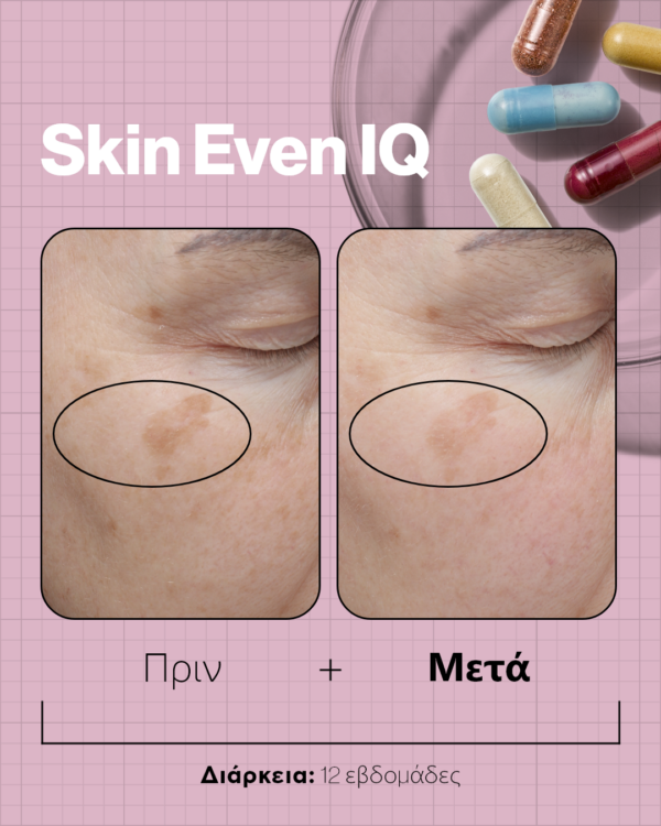Skin Even IQ (Skin Bright, Skin Blue Filter, Skin Vit C, Skin Antioxidant, Skin Co -Q10+) - Image 3