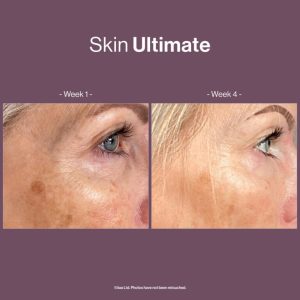 Skin Ultimate (Skin Vit A+,Skin Antioxidant,Skin Omegas+,Skin CoQ10 και Skin Astaboost)