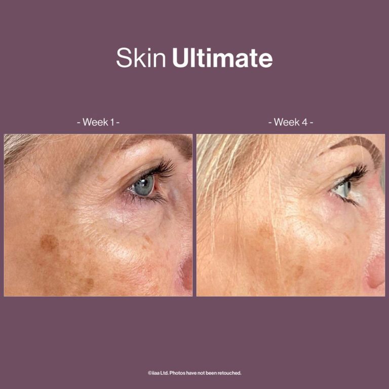 Skin Ultimate (Skin Vit A+,Skin Antioxidant,Skin Omegas+,Skin CoQ10 και Skin Astaboost)